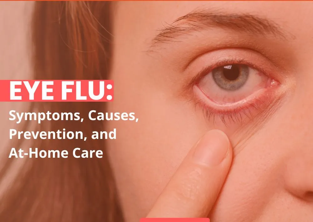 Eye Flu Symptoms Causes Prevention and At-Home Care